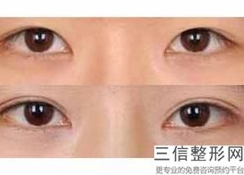 纹眼线的步骤，什么叫纹眼线