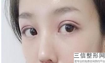 纹眼线的步骤，什么叫纹眼线