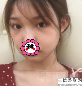 武汉漂唇哪家医院好，漂唇哪里比较正规