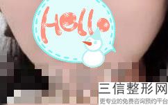 武汉漂唇哪家医院好，漂唇哪里比较正规