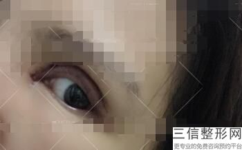 眼线要纹吗，纹眼线有什么注意事项