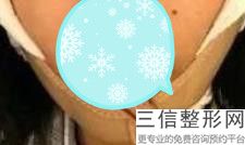 怎么样可以让嘴唇变薄变小，如何让嘴唇变小变薄天然方法