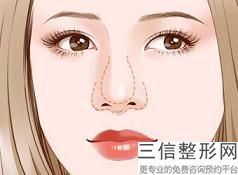 自体脂肪隆胸有几种方法,自体脂肪隆胸禁忌症