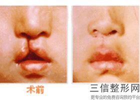 做什么唇形好看，如何让唇形好看