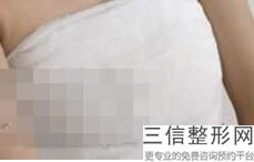 成都有名的隆胸医生排名前十,2022王建平排名靠前