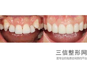 成都正规的牙科医院排行榜前三名单公示,2022成都博爱医院口腔科口碑不错