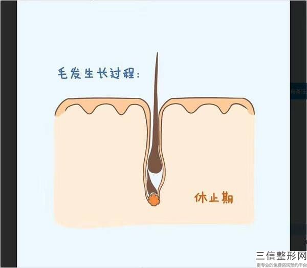 成都正规植发医院有哪些,2022成都丝缘植发医疗美容医院口碑良好