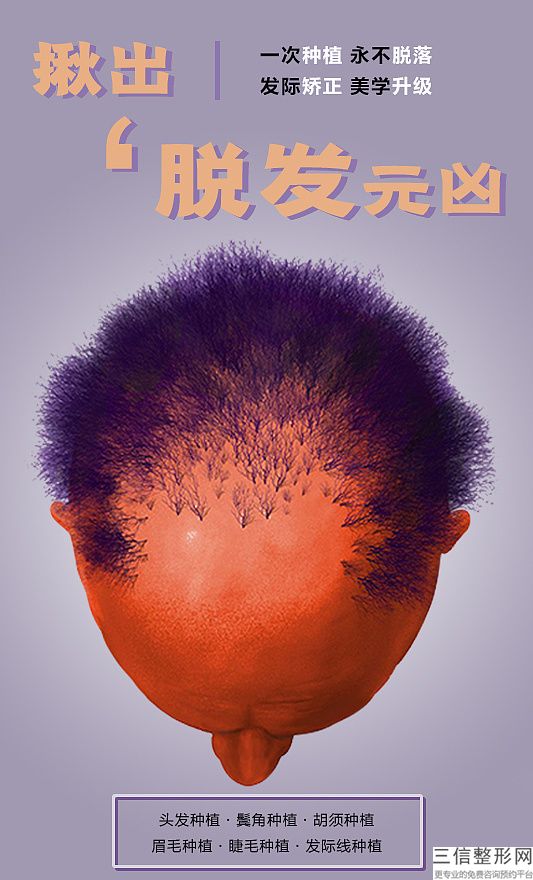 成都植发医院排名表前四口碑测评,2022成都碧莲盛植发医院实力上榜
