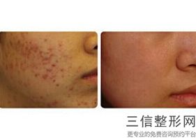 成都做热玛吉十强医院有哪些,2022成都娇点医疗美容医院实力上榜