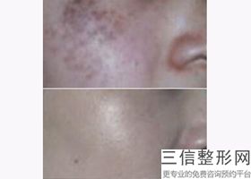 成都十大公立整形医院是哪些,2022四川省第四人民医院皮肤科实力超强