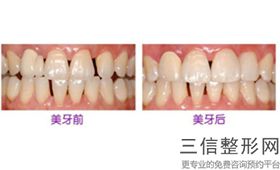 成都十大正畸医院排行榜,2022成都圣贝口腔首次上榜