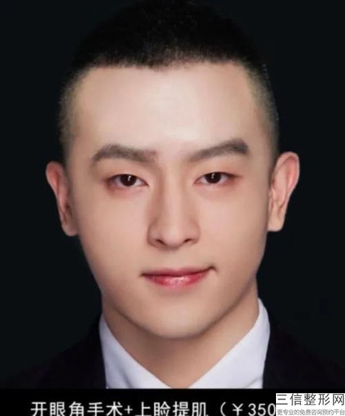 成都植发医院哪家好,2022成都丝缘植发实力超强