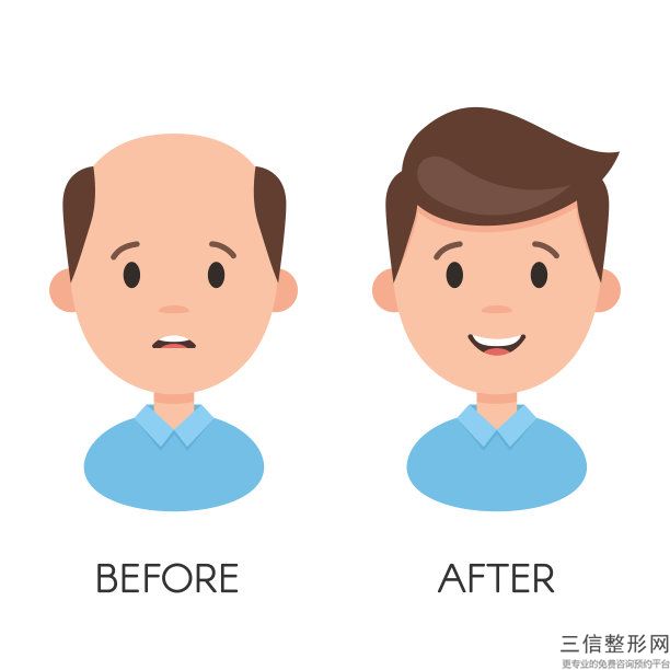 成都植发医院排行榜前八强,2022成都碧莲盛植发医院实力非凡