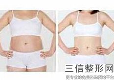 北京脂肪丰胸好的医院有哪些,2022北京联合丽格医疗美容诊所不容错过