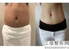 北京脂肪丰胸在哪个医院做好,2022北京联合丽格医疗美容诊所口碑不错