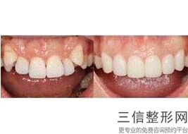 北京种植牙口腔医院汇总目录名单,2022北京佳美口腔实力非凡