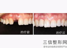北京种植牙口腔医院排名前十哪个技术比较好,2022北京康贝佳口腔实力上榜