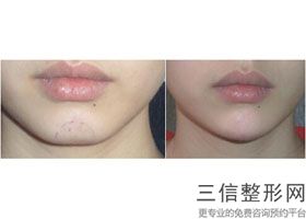 北京嘴唇整形医院排名前十快准狠,2022北京壹加壹医疗美容门诊部首次上榜