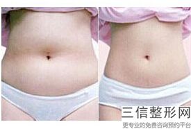 北京做丰胸好的医院排行名单,2022北京煤医西坝河医疗美容医院位列前十