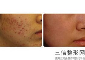北京做拉皮好的医生排行榜前十盘点,2022柳明熙教授排名靠前