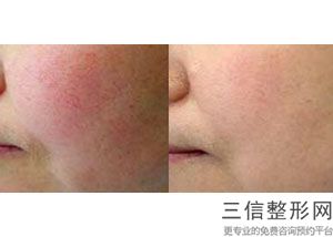 北京做拉皮排前五整容医院,2022北京加减美医疗美容医院遥遥领先