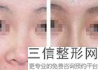 北京做隆鼻去哪家医院好,2022北京艾玛医疗美容医院不容错过