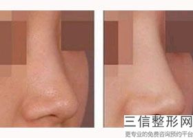 北京做隆鼻整形医院哪家好,2022北京华韩医疗美容整形医院锁定前十