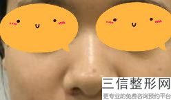 北京做隆鼻整形医院哪家好,2022北京沃尔医疗美容医院排名靠前