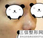 北京做隆鼻整形医院排名前六信息公示,2022北京八大处位列前十