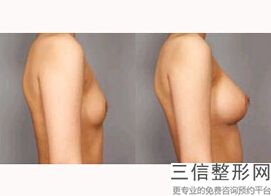 北京做隆胸厉害的医生排行榜前十,2022 【高亚东】副主任医师不容错过