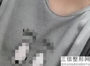 北京做隆胸厉害的医生排名前十汇总,2022王晓军医生口碑不错