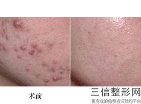 北京做皮秒好的医院排行榜前十,2022北京知音遥遥领先