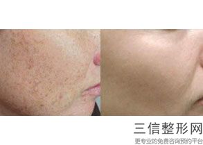 北京做热玛吉好的医院,2022北京玉之光整形美容医院实力超强