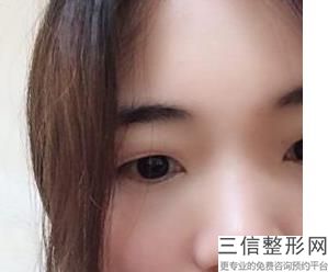 北京做修复内眼角的专家排名及时公布,2022 王世勇首次上榜