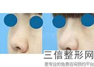 北医三院整形科和上海九院隆鼻哪个好,2022医院简介：口碑不错
