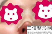 鼻王排名前十名单介绍,2022【林军】主治医师口碑不错