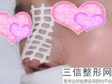 鼻王排名专家哪个好,2022李青峰位列前十