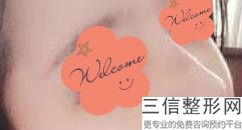 亳州隆鼻整形医院哪家好,2022亳州市微悦整形医疗美容门诊部排名靠前