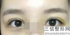 常德去眼袋整形医院排名前十,2022常德韩美整形美容门诊部首次上榜
