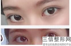 常州看近视眼哪个医院比较好,2022 常州市武进中医院眼科位列前十