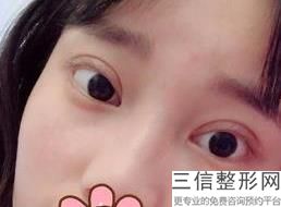 常州眼科医院排名榜,2022常州市第一人民医院-眼科不容错过
