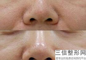 超火的北京拉皮医生排名前七强,2022杨庆华医生实力超强