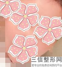 唇腭裂能修复好吗,唇腭裂能修复吗