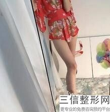 大腿抽脂手术后注意事项，做完大小腿吸脂要注意什么