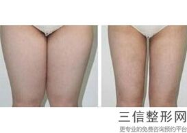 丰胸有哪些好方法，什么是丰胸的良好方法