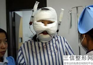 佛山吸脂瘦脸要多少钱,佛山哪里抽脂好