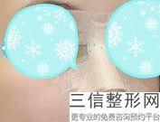 胶原蛋白隆鼻子，胶原蛋白隆鼻术