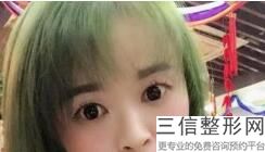 开内眼角和开外眼角的不同之处，眼睛开内外眼角的区别