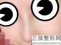 隆鼻那个材料良好，隆鼻用什么材料较好