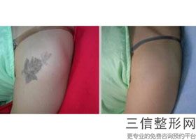 美白针真的可以美白吗-，美白针效果好嘛